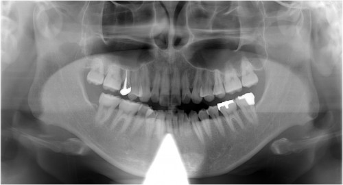 川畑１　初診時　◎